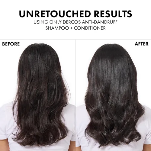 Vista 3 de Dercos Dandruff Shampoo, Antifungal Dry Scalp Treatment & Itchy Scalp Relief, Prescription Strength Selenium Sulfide Comparable to 2% Ketoconazole